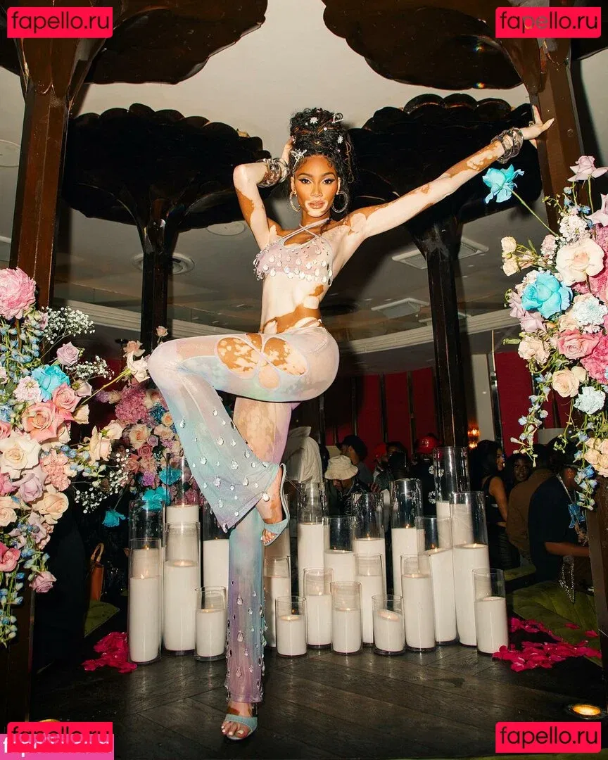 Winnie Harlow Onlyfans Photo Gallery 