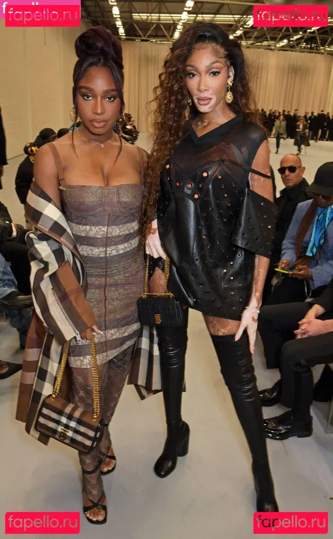 Winnie Harlow Onlyfans Photo Gallery 