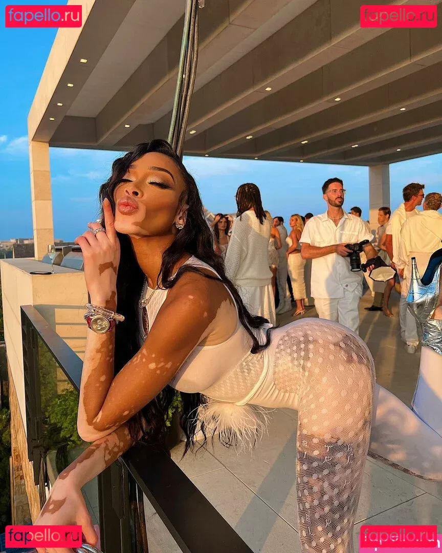 Winnie Harlow Onlyfans Photo Gallery 
