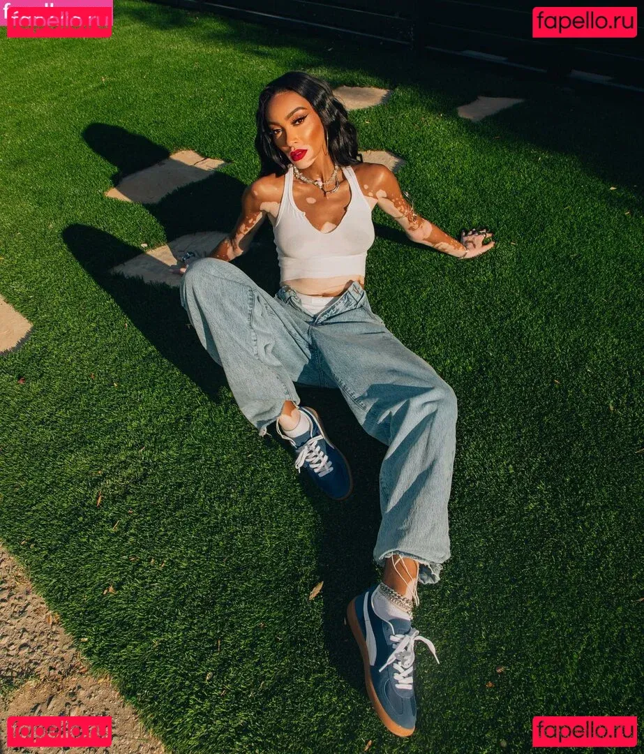 Winnie Harlow Onlyfans Photo Gallery 