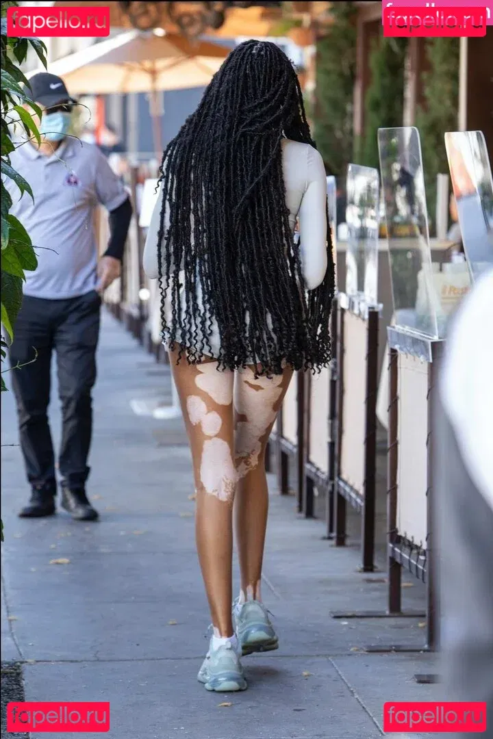 Winnie Harlow Onlyfans Photo Gallery 