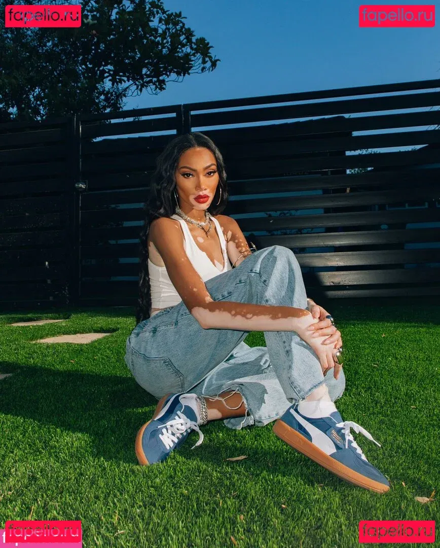 Winnie Harlow Onlyfans Photo Gallery 