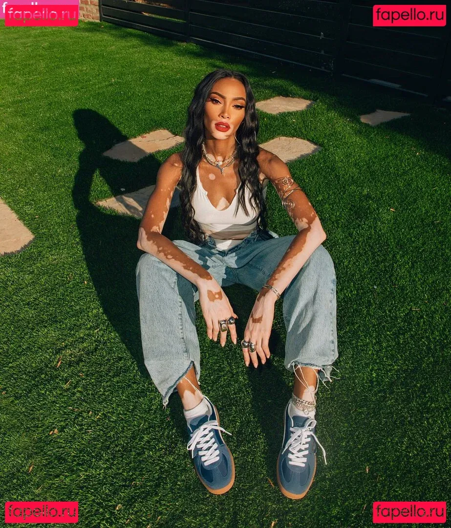Winnie Harlow Onlyfans Photo Gallery 