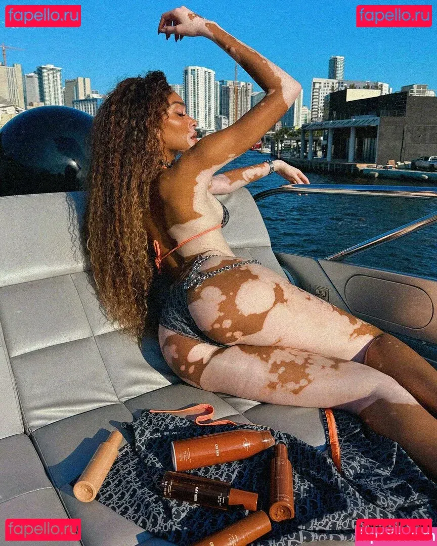 Winnie Harlow Onlyfans Photo Gallery 