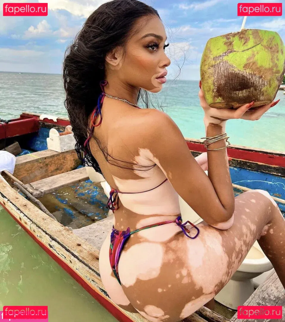 Winnie Harlow Onlyfans Photo Gallery 