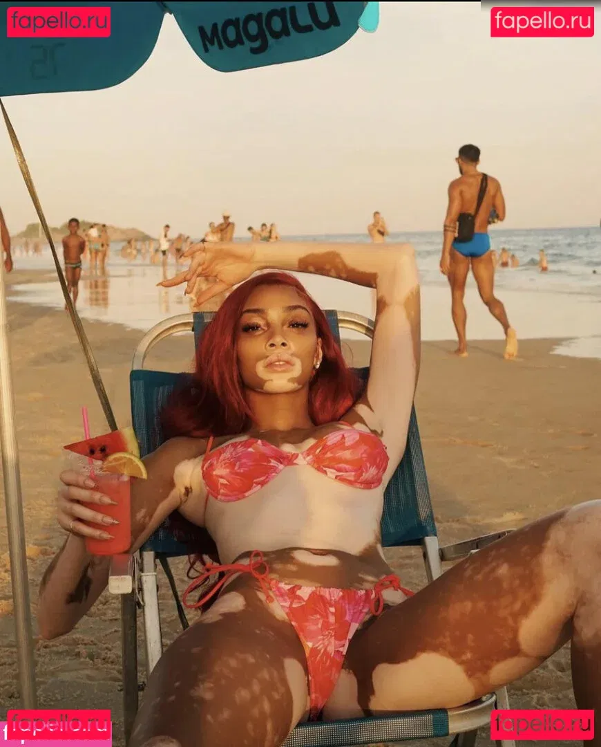 Winnie Harlow Onlyfans Photo Gallery 