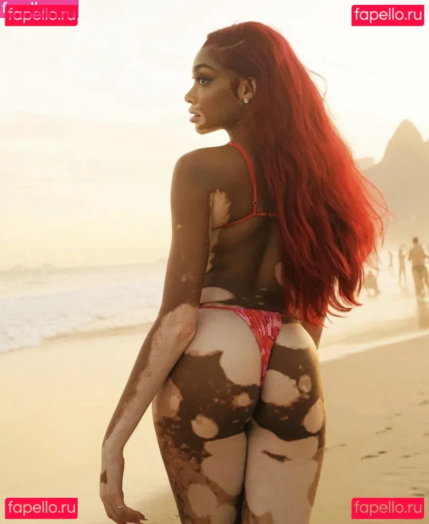 Winnie Harlow Onlyfans Photo Gallery 