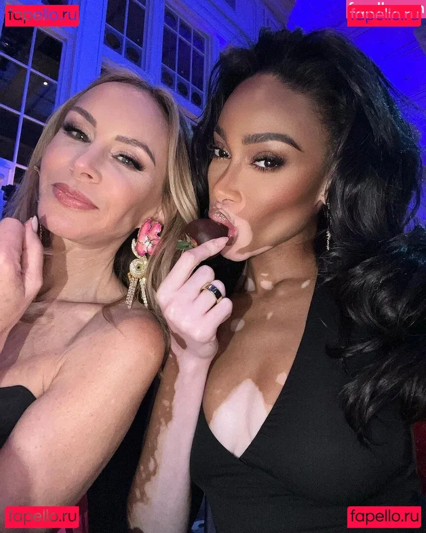 Winnie Harlow Onlyfans Photo Gallery 