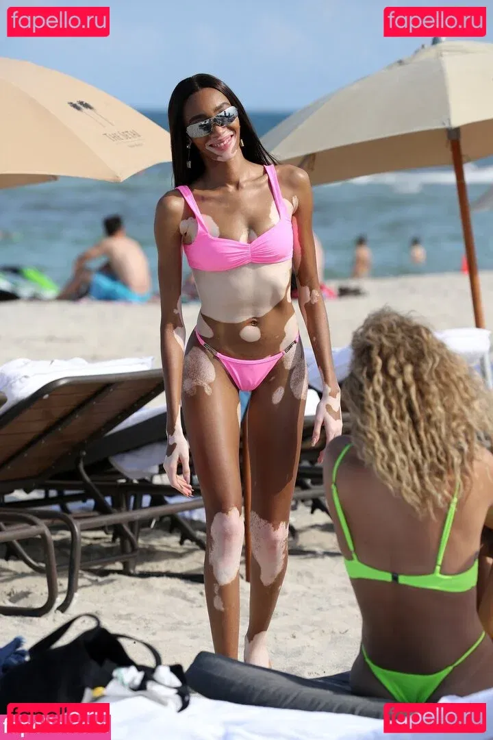 Winnie Harlow Onlyfans Photo Gallery 