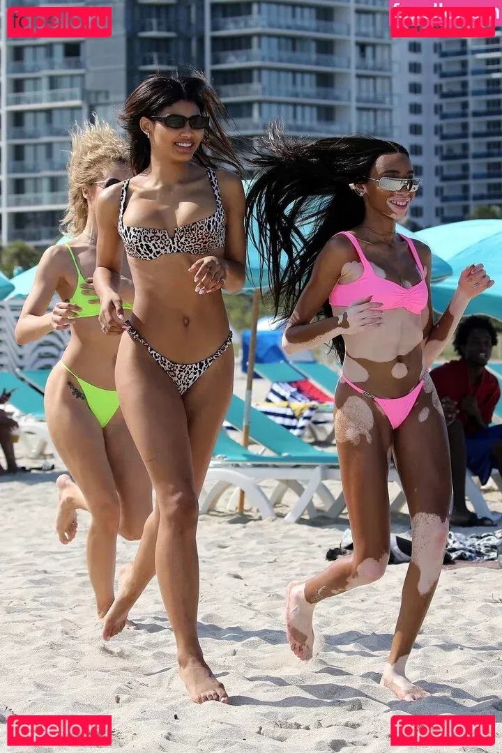 Winnie Harlow Onlyfans Photo Gallery 