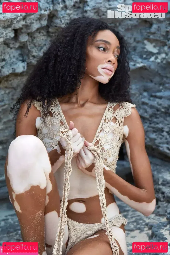 Winnie Harlow Onlyfans Photo Gallery 