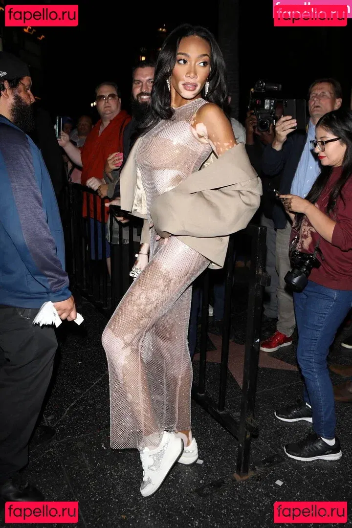 Winnie Harlow Onlyfans Photo Gallery 