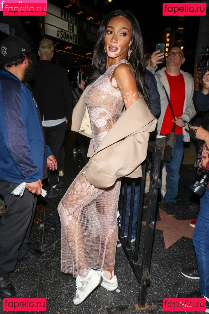 Winnie Harlow Onlyfans Photo Gallery 