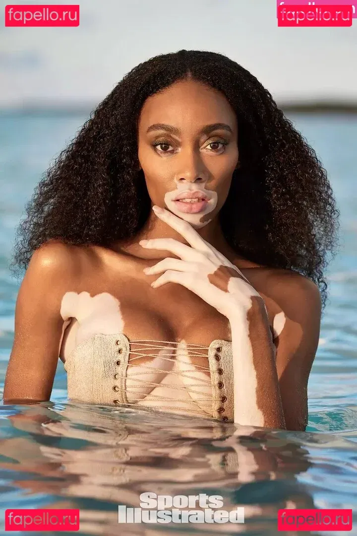 Winnie Harlow Onlyfans Photo Gallery 