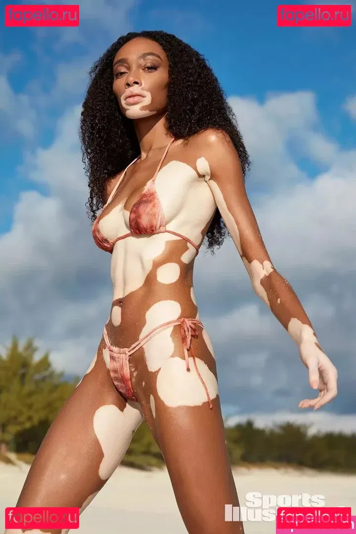 Winnie Harlow Onlyfans Photo Gallery 