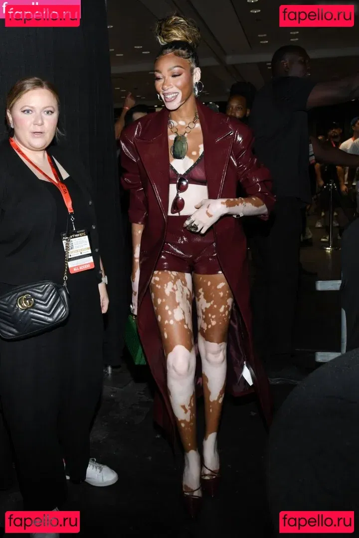 Winnie Harlow Onlyfans Photo Gallery 