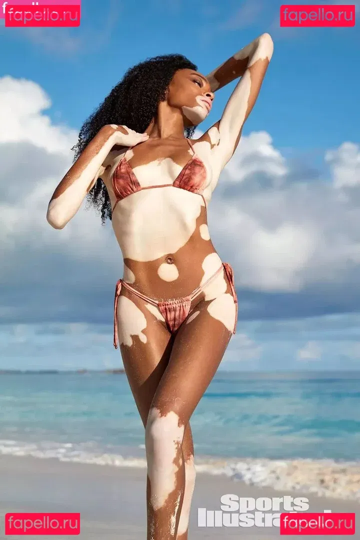 Winnie Harlow Onlyfans Photo Gallery 