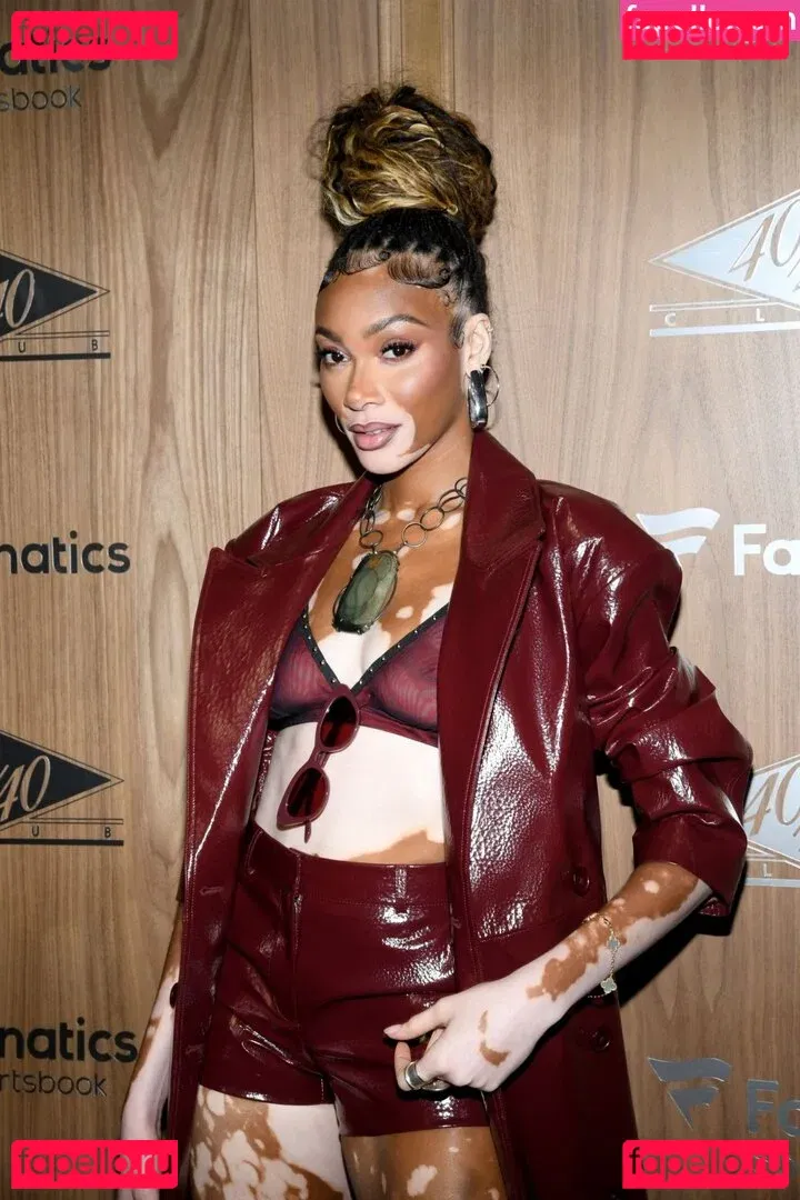 Winnie Harlow Onlyfans Photo Gallery 