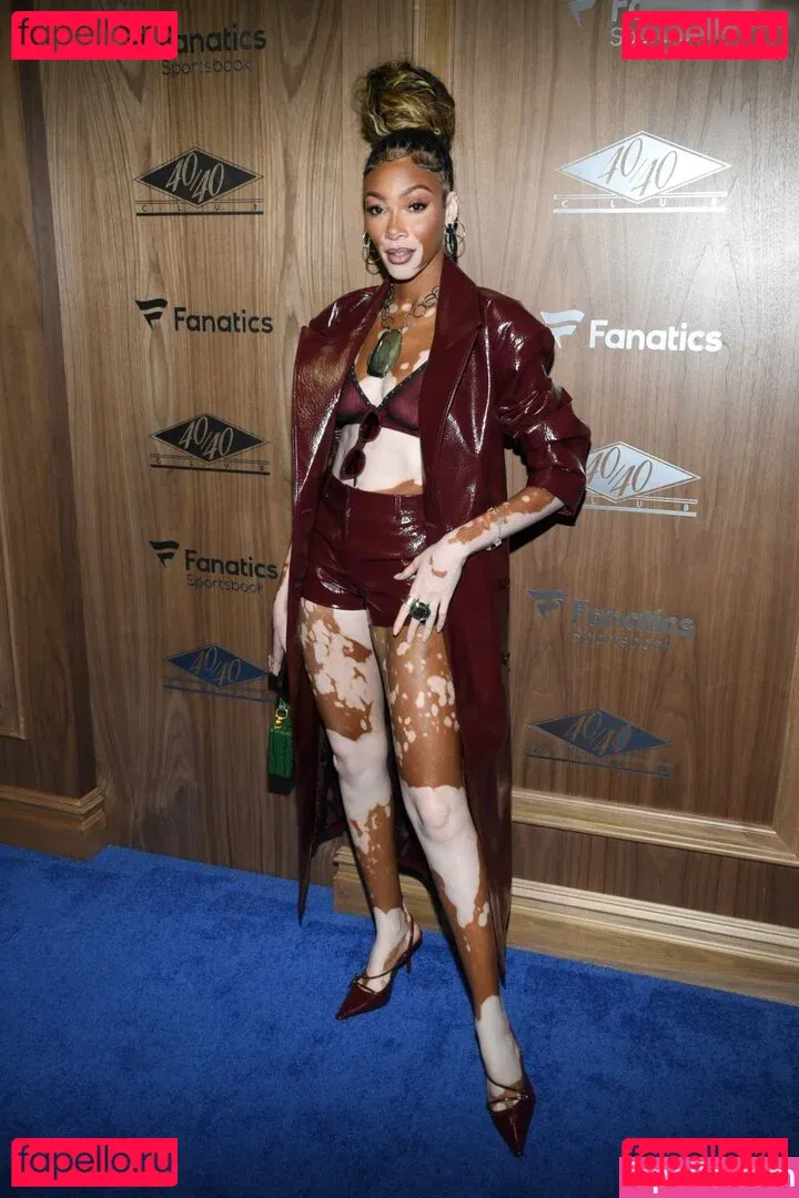 Winnie Harlow Onlyfans Photo Gallery 