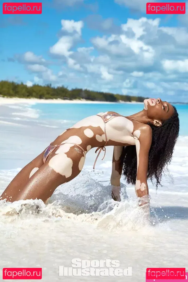 Winnie Harlow Onlyfans Photo Gallery 