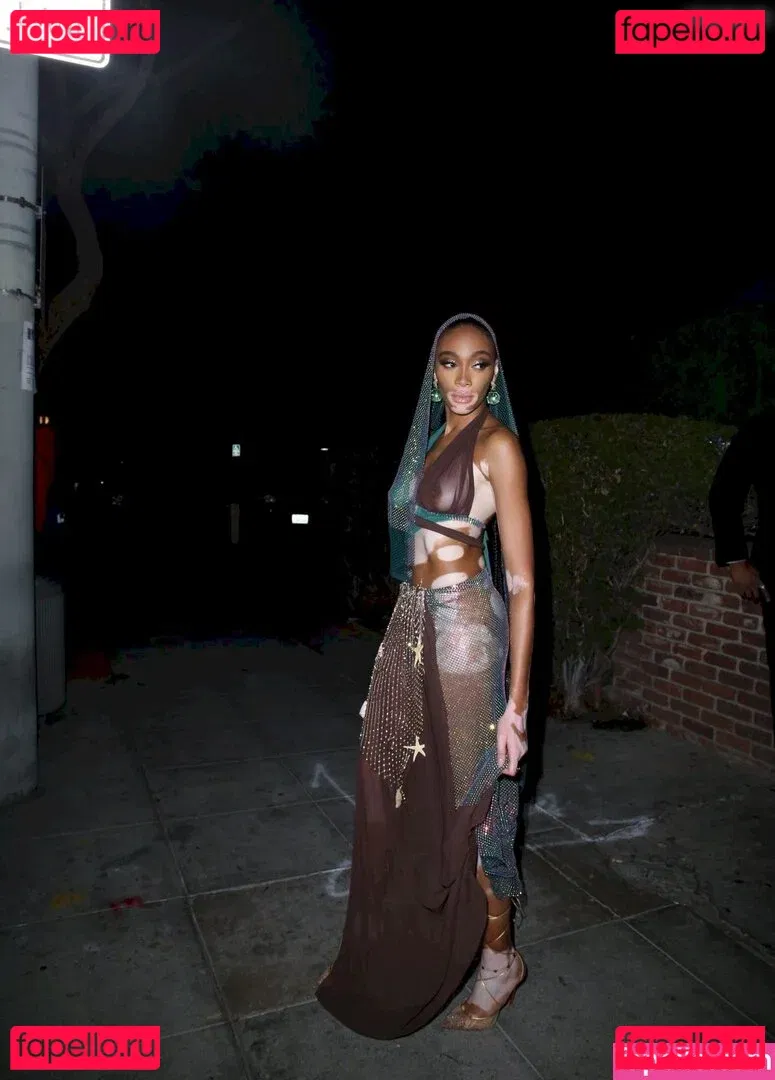 Winnie Harlow Onlyfans Photo Gallery 