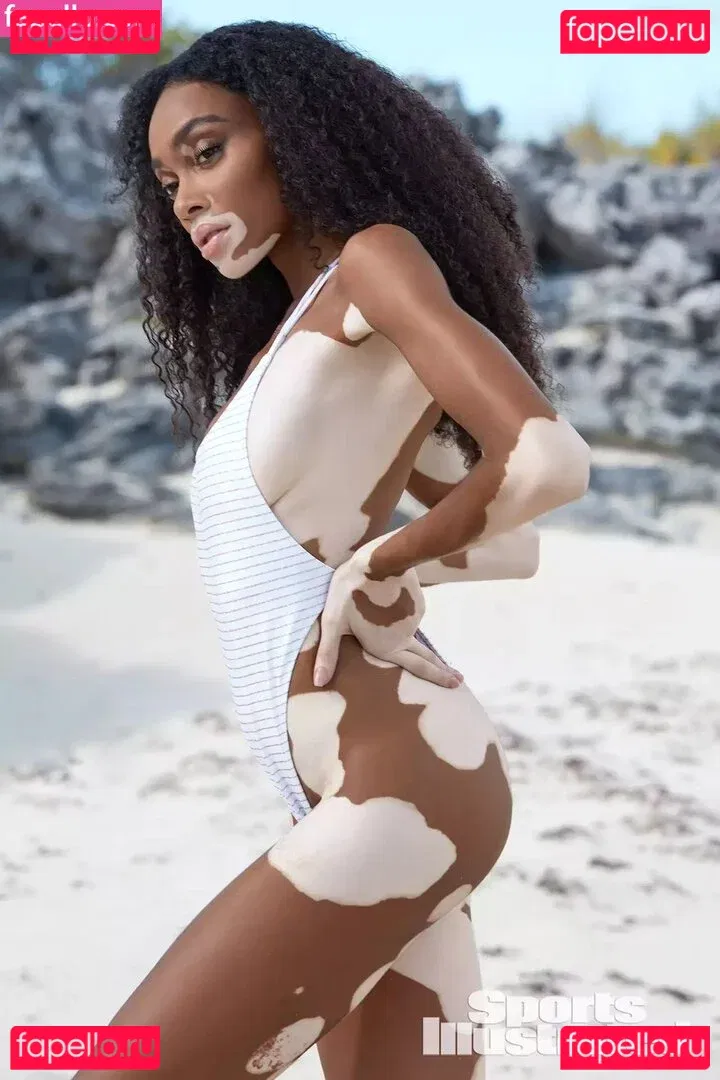 Winnie Harlow Onlyfans Photo Gallery 