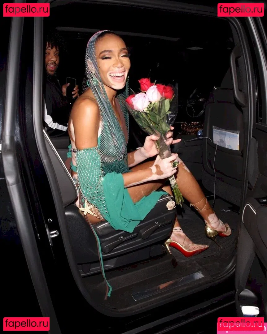 Winnie Harlow Onlyfans Photo Gallery 