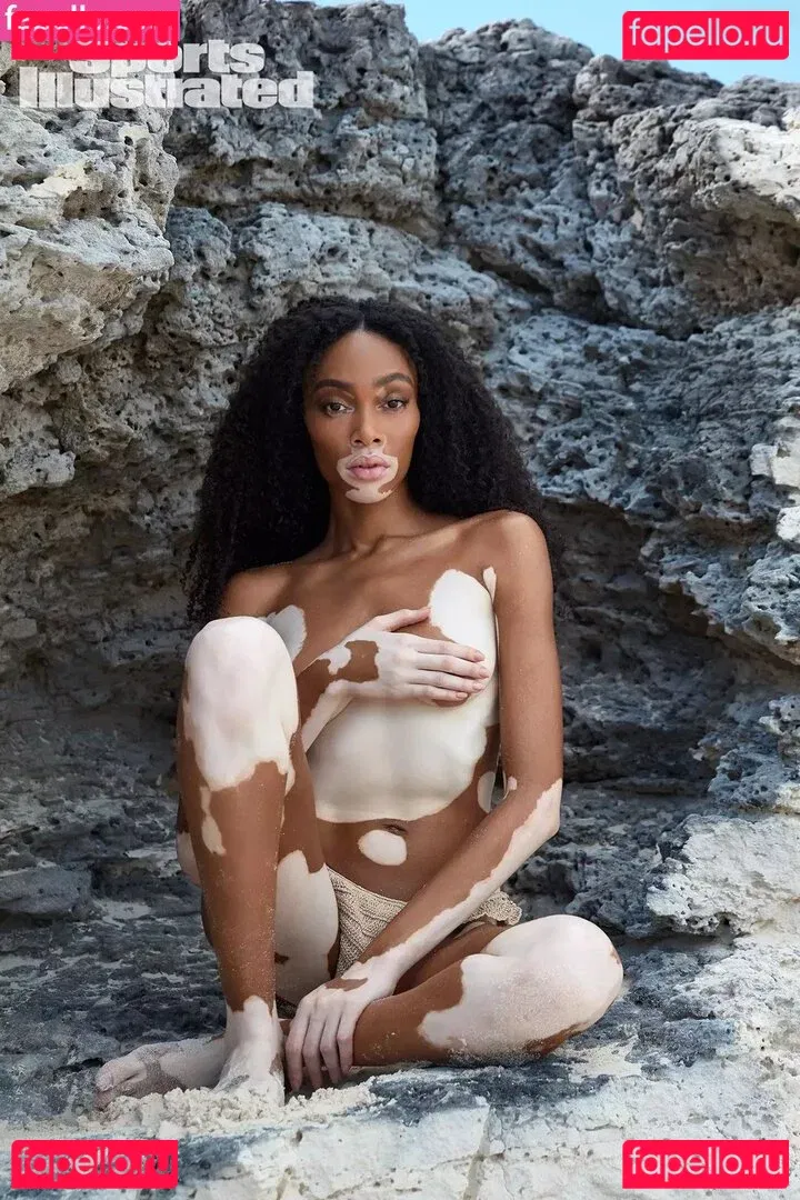 Winnie Harlow Onlyfans Photo Gallery 