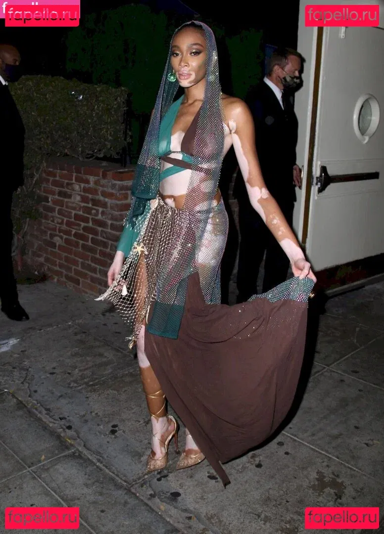 Winnie Harlow Onlyfans Photo Gallery 