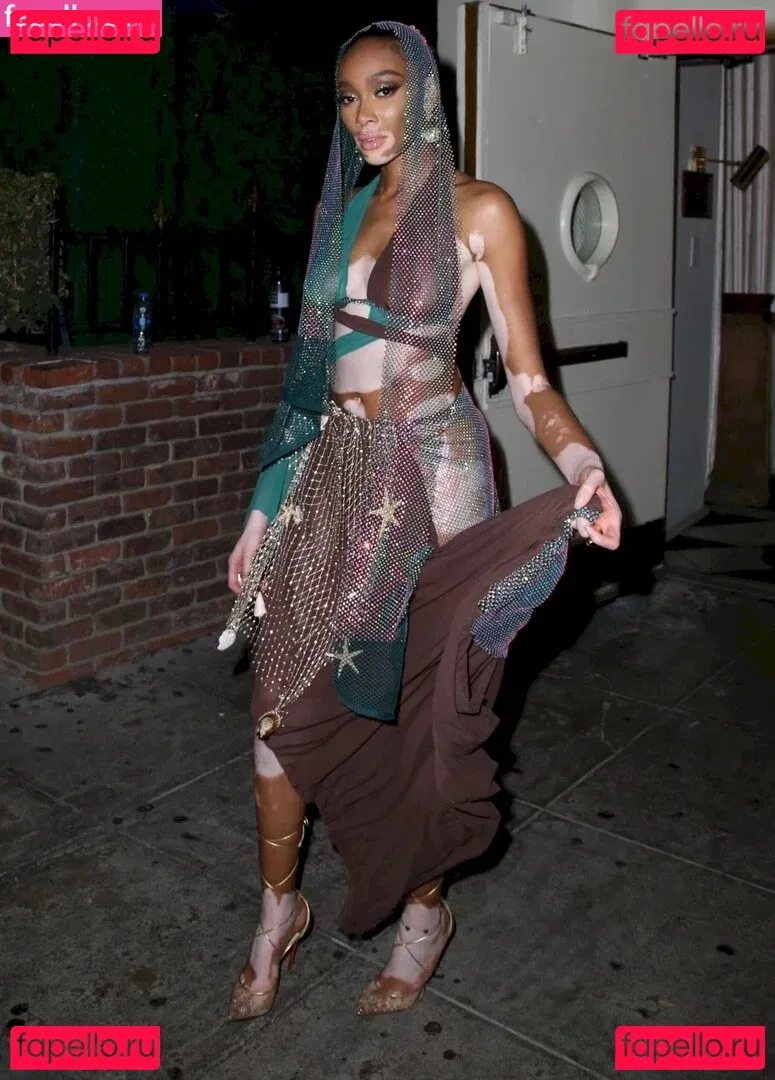 Winnie Harlow Onlyfans Photo Gallery 