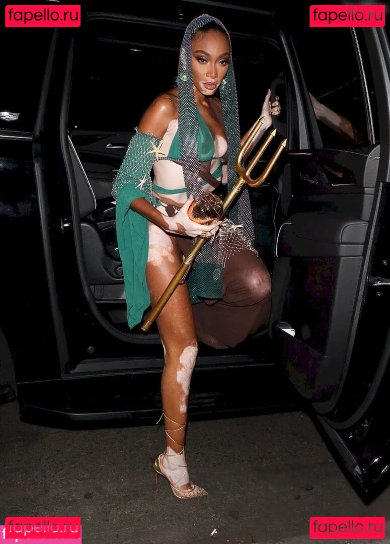 Winnie Harlow Onlyfans Photo Gallery 