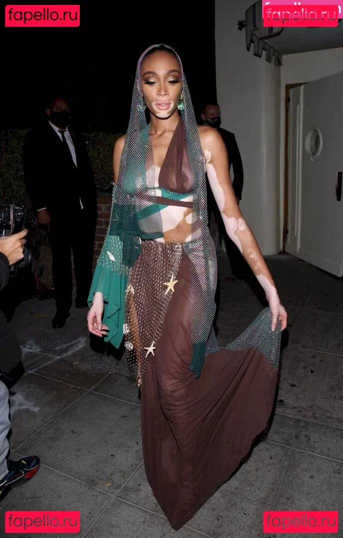 Winnie Harlow Onlyfans Photo Gallery 