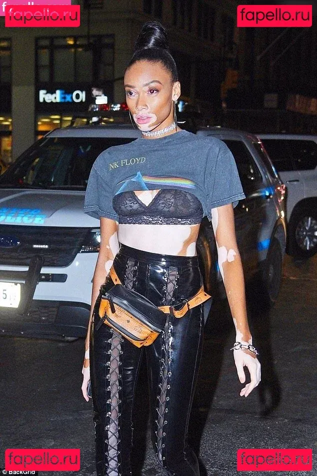 Winnie Harlow Onlyfans Photo Gallery 