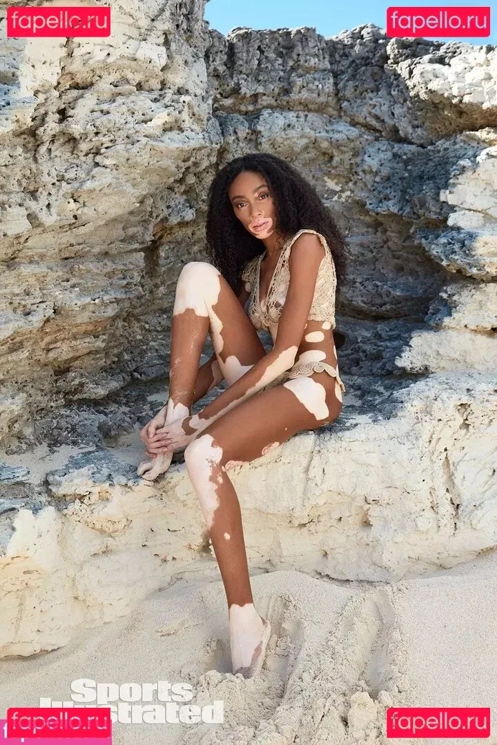 Winnie Harlow Onlyfans Photo Gallery 