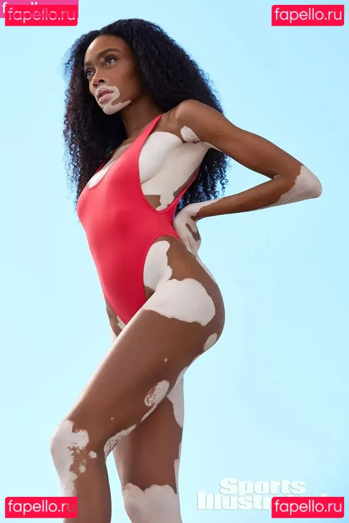 Winnie Harlow Onlyfans Photo Gallery 