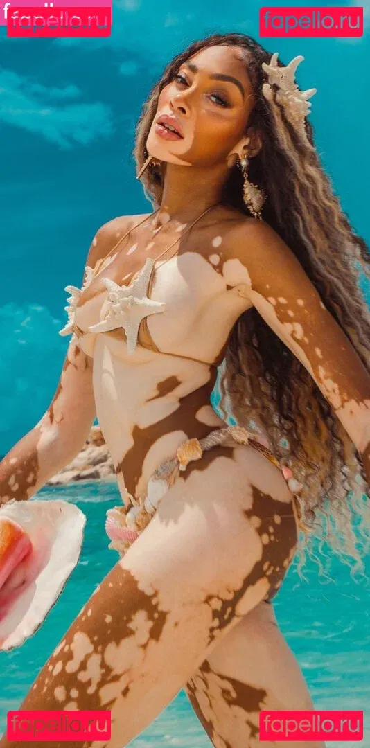 Winnie Harlow Onlyfans Photo Gallery 