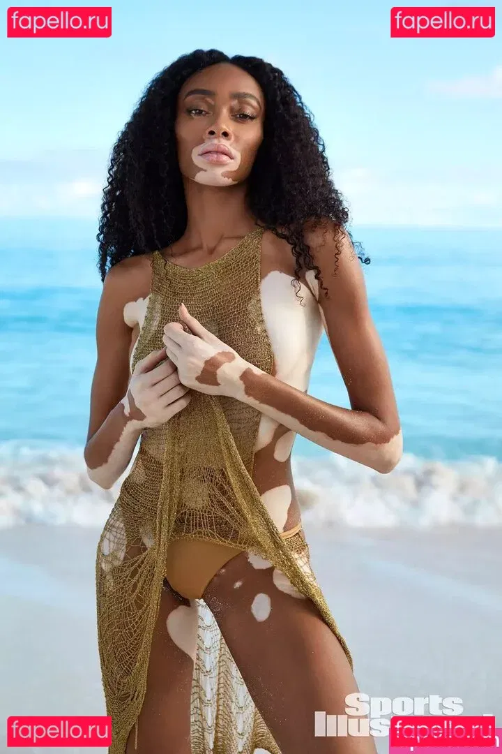 Winnie Harlow Onlyfans Photo Gallery 