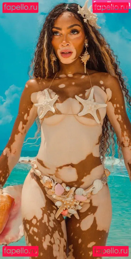 Winnie Harlow Onlyfans Photo Gallery 