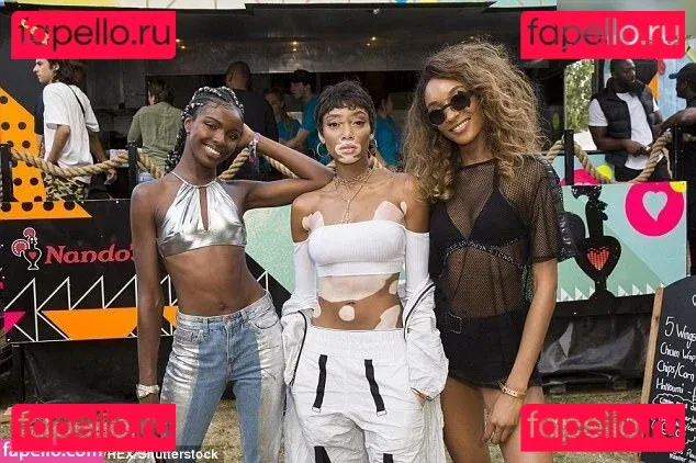 Winnie Harlow Onlyfans Photo Gallery 