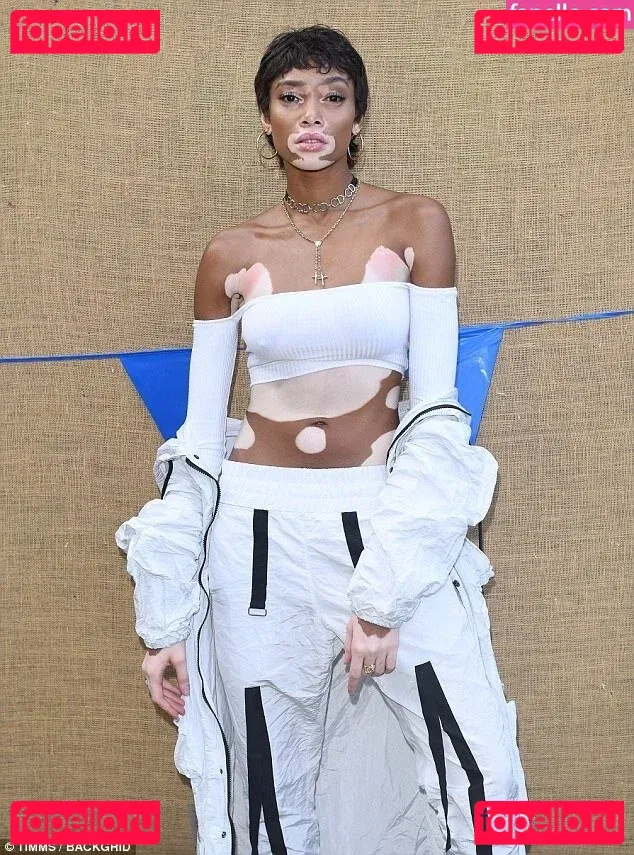 Winnie Harlow Onlyfans Photo Gallery 