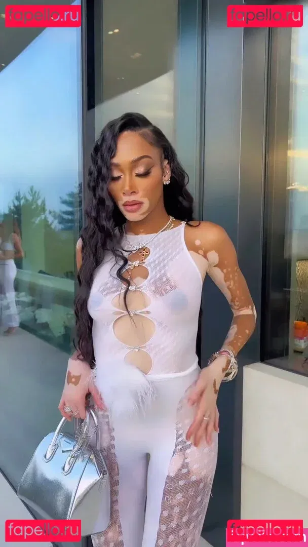 Winnie Harlow Onlyfans Photo Gallery 