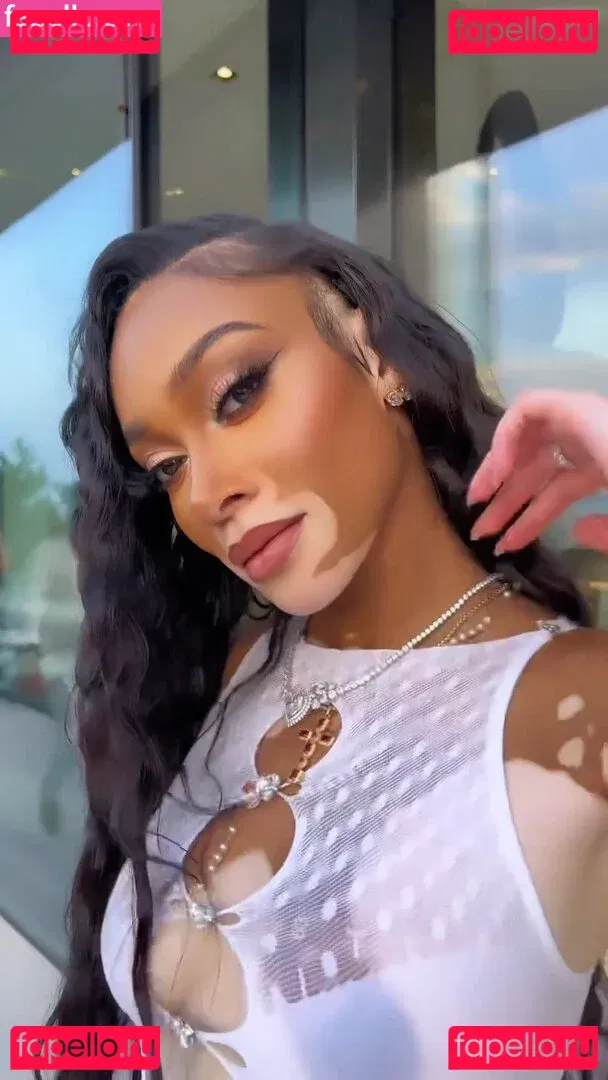 Winnie Harlow Onlyfans Photo Gallery 
