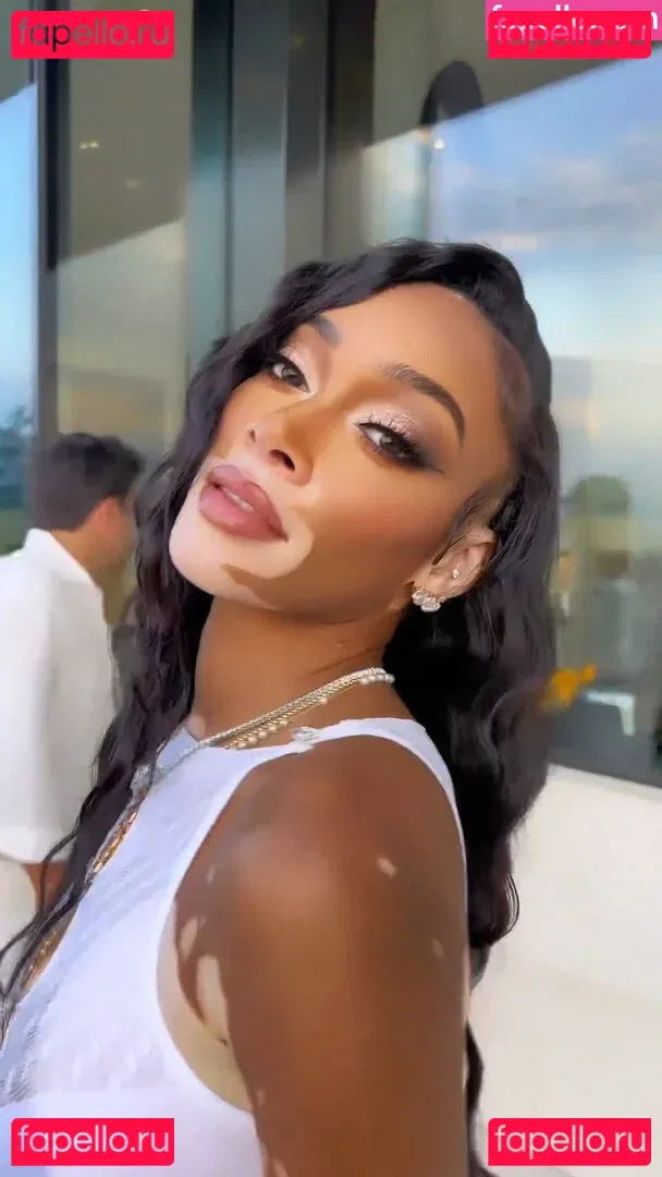 Winnie Harlow Onlyfans Photo Gallery 