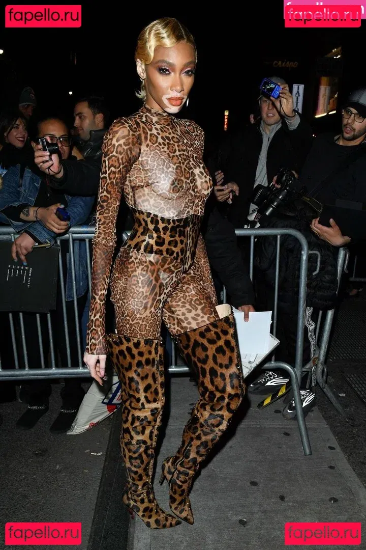 Winnie Harlow Onlyfans Photo Gallery 