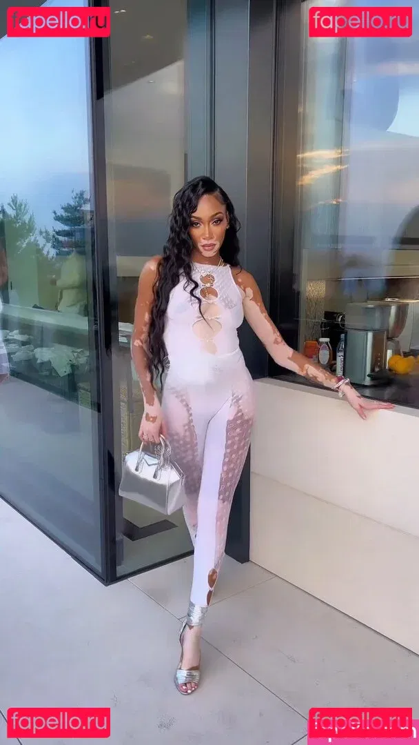 Winnie Harlow Onlyfans Photo Gallery 
