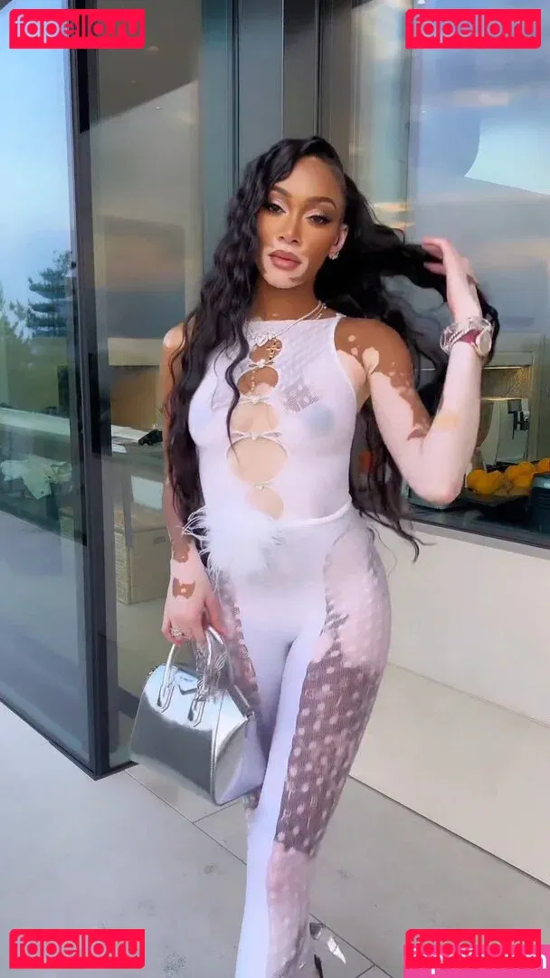 Winnie Harlow Onlyfans Photo Gallery 