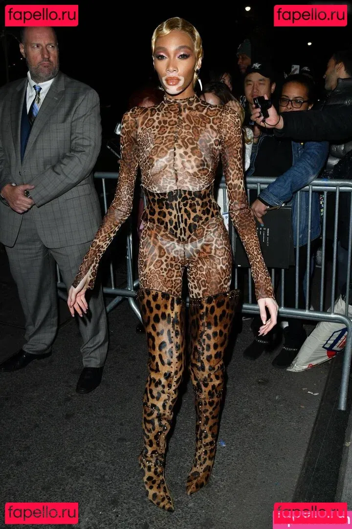 Winnie Harlow Onlyfans Photo Gallery 