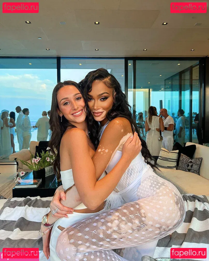 Winnie Harlow Onlyfans Photo Gallery 