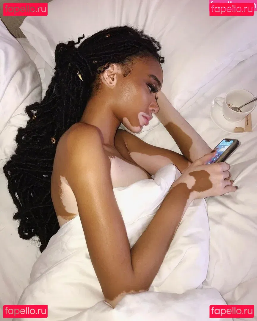 Winnie Harlow Onlyfans Photo Gallery 