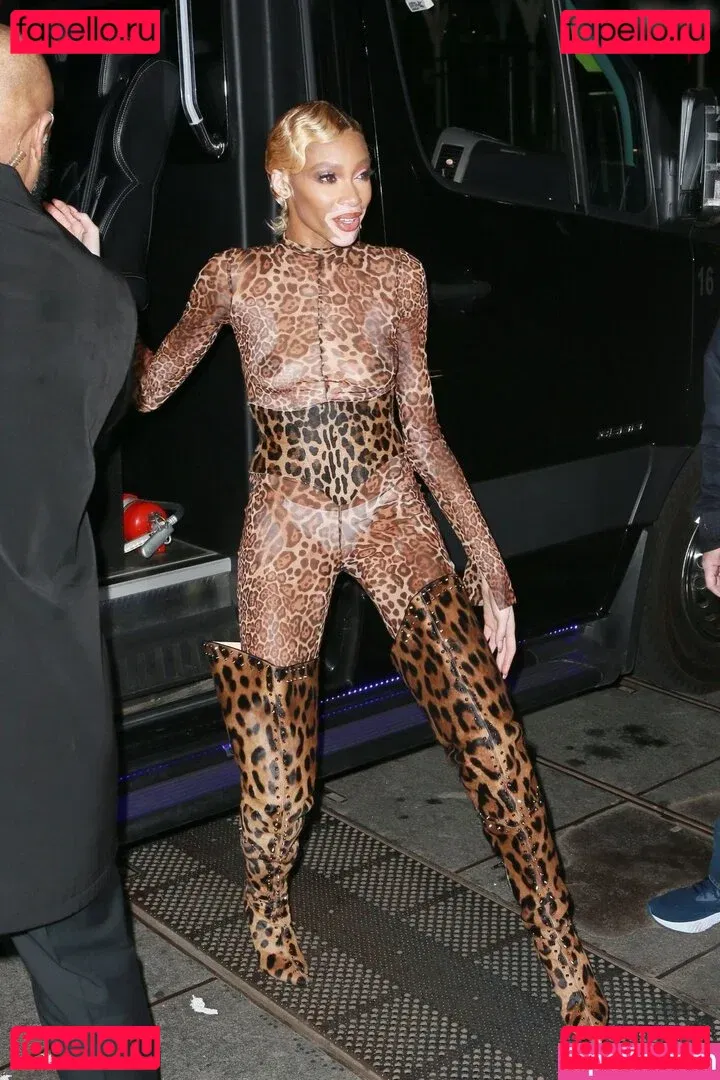 Winnie Harlow Onlyfans Photo Gallery 